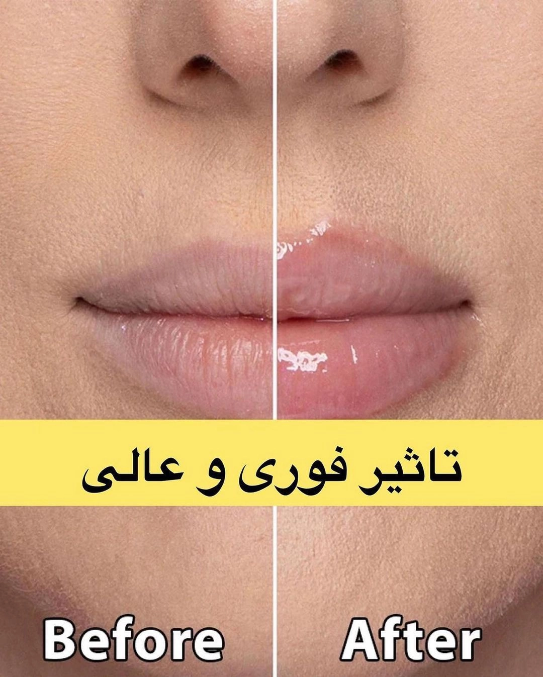 حجم دهنده لب مدل فلفلی کیس بیوتی