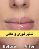 حجم دهنده لب مدل فلفلی کیس بیوتی