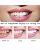 سرم سفید کننده فوری دندان برند لانبنا اورجینال بدون آسیب به دندان ها