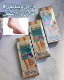 کرم رفع ترک پا ووکالی سایز بزرگ ۱۳۰ میل