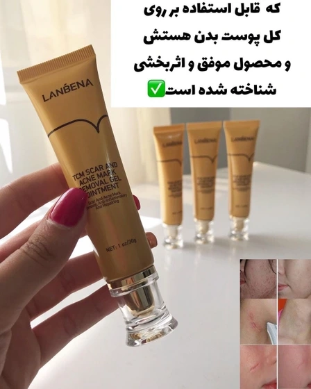 کرم ترمیم کننده جای سوختگی ، زخم، بخیه برند لانبنا