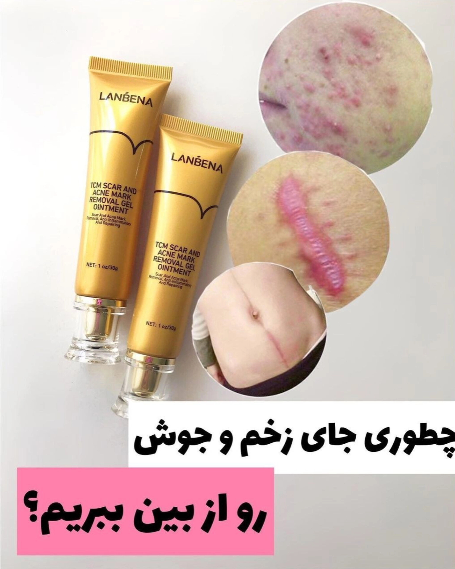 کرم ترمیم کننده جای سوختگی ، زخم، بخیه برند لانبنا