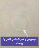 چسب ضد جوش اورژانسی مدل ورقه ای برند سادور 40 عددی